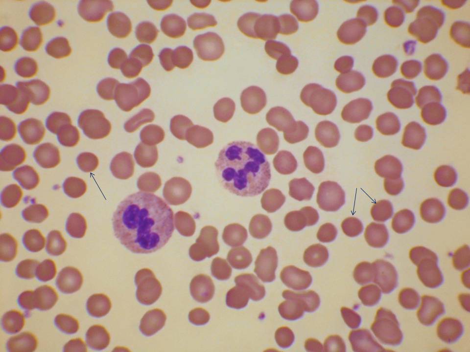 Spherocytes